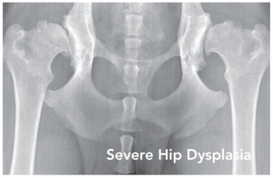 pennhip displasia de cadera